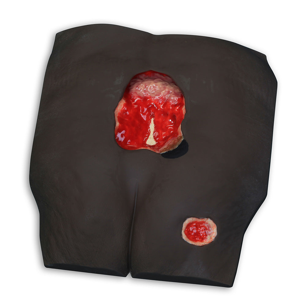 Stan Estágio 4, Escuro [SKU: V0975]