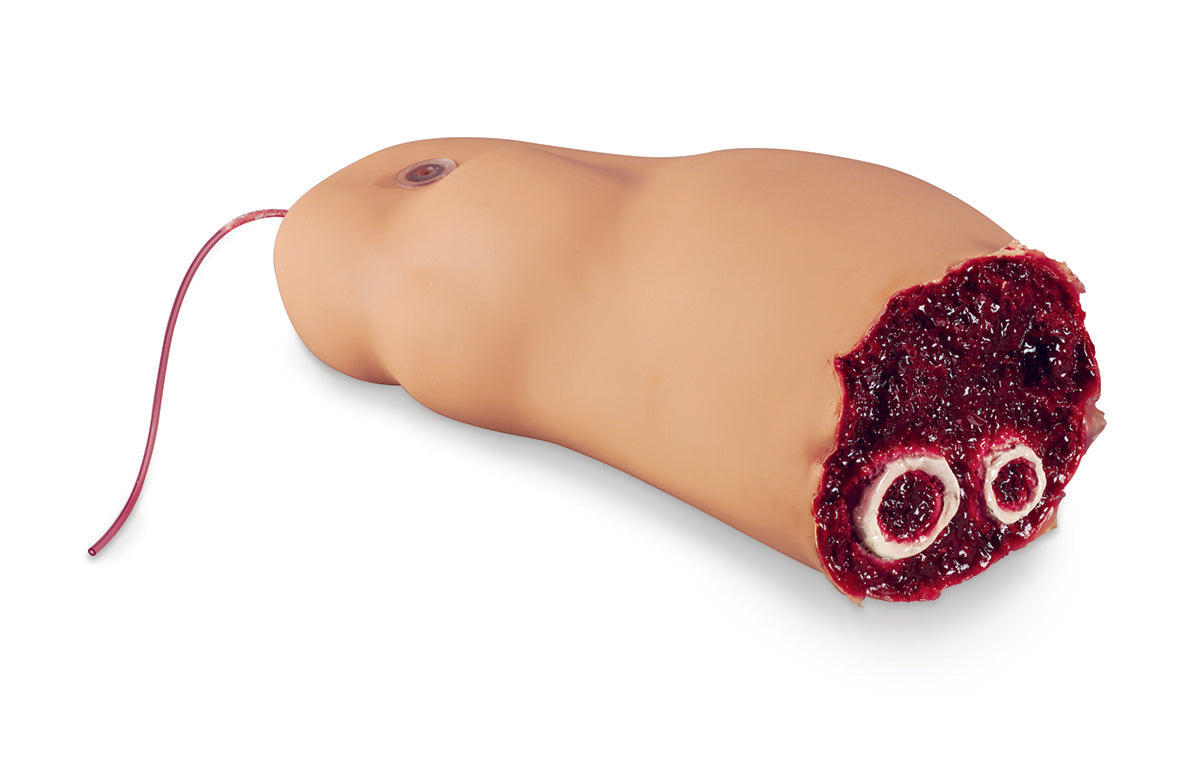 Estatística inteligente de perna amputada