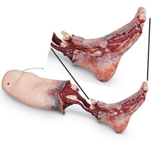 3130312D343832 Smart Stat Xtreme Trauma Sangramento na Perna