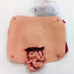 Ferida abdominal com intestinos salientes