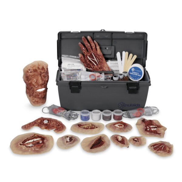 Kit de fundição Xtreme Trauma [SKU: 800-620]