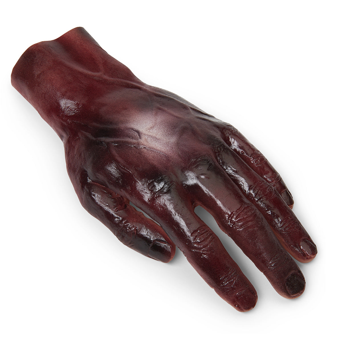 Queimadura, Mão, 2º/3º Grau, Escuro