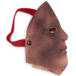 Queimadura Facial 2º e 3º Grau