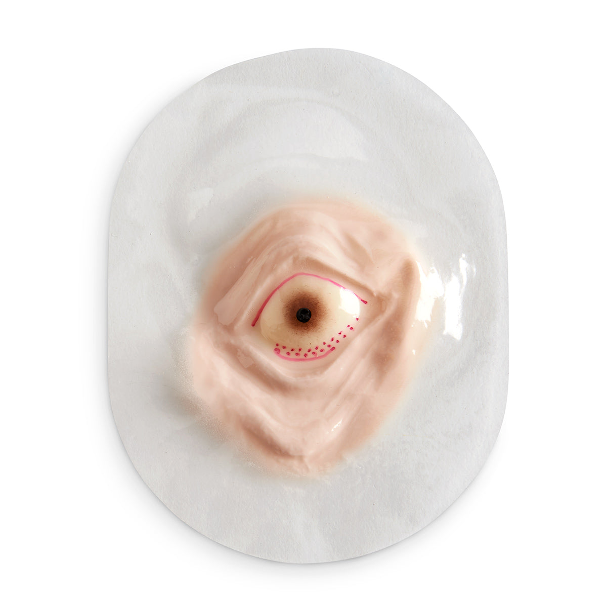 Ferida de petéquias