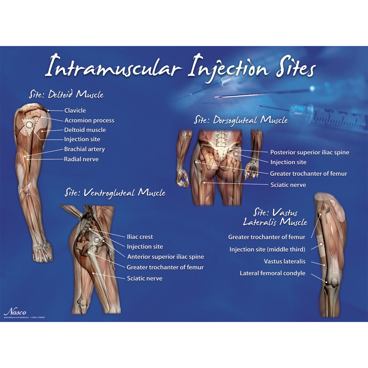 Conjunto de locais de injeção intramuscular
