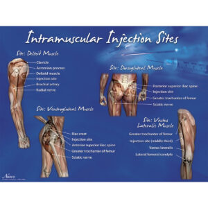 Cartaz de locais de injeção intramuscular