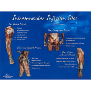 Tabela de locais de injeção intramuscular