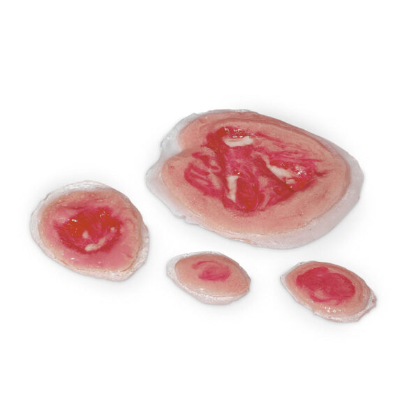 Life/form® Wound – Úlceras de pressão