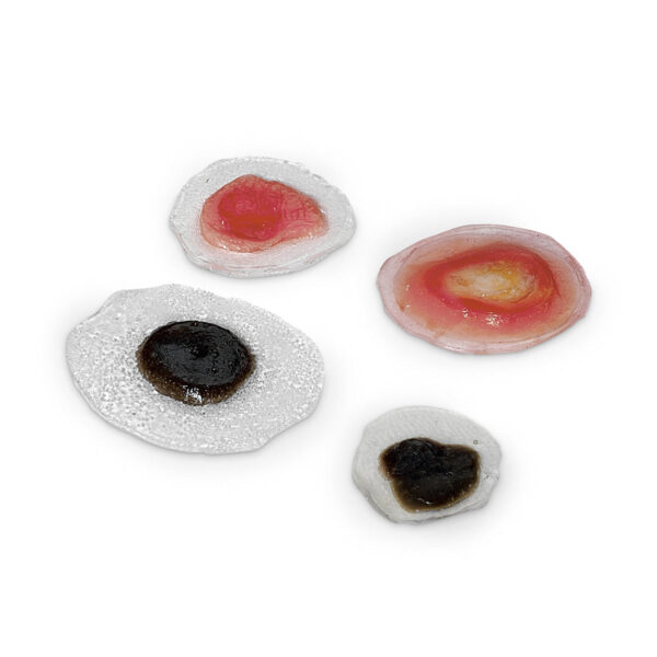 Life/form® Wound – Sinais/Câncer de Pele