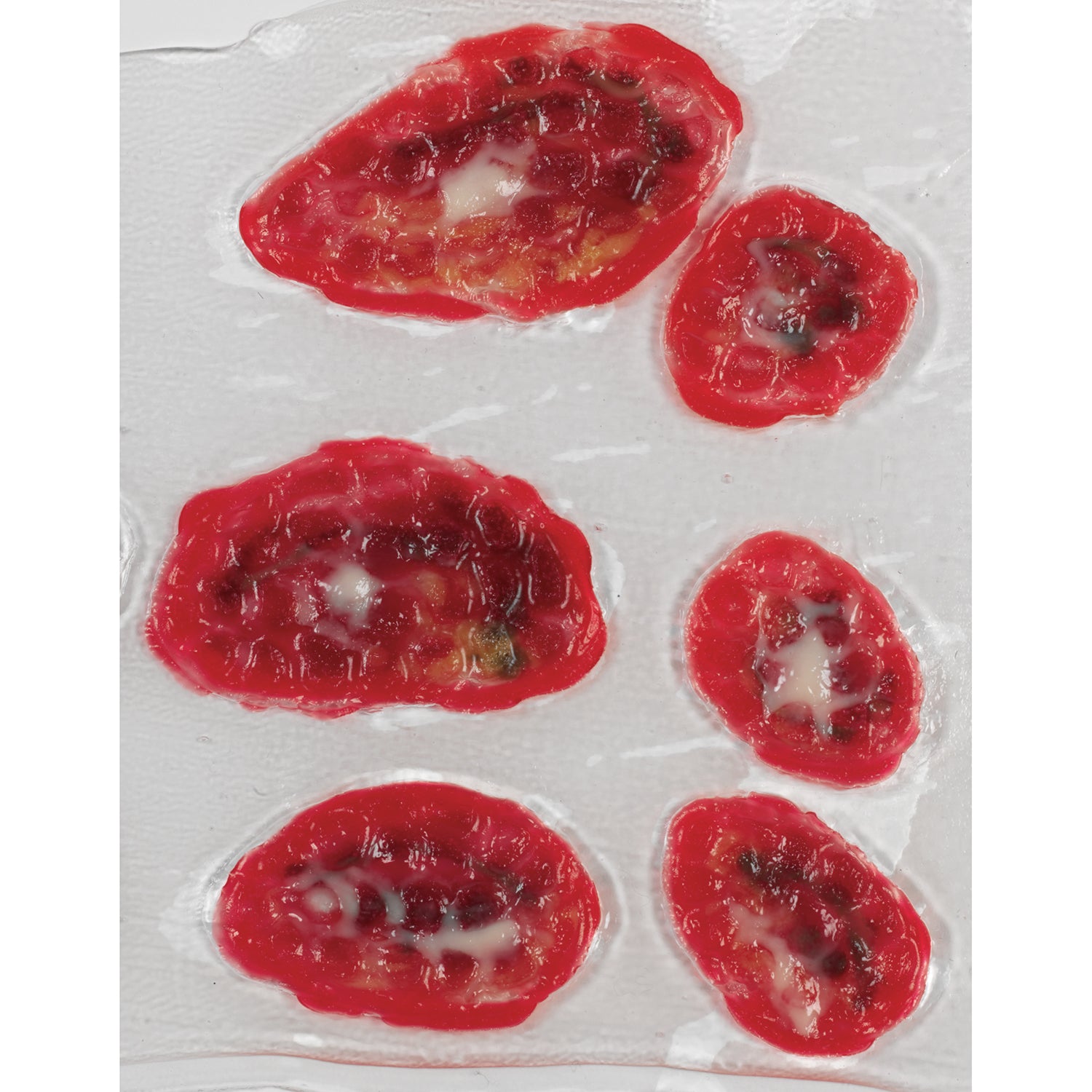 Úlcera de estase venosa Life/form®