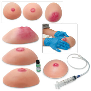 Réplicas de condições mamárias comuns Life/form® – Conjunto de 4 [SKU: LF00864]