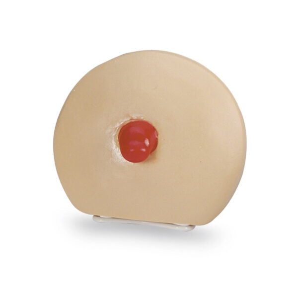 Modelo de treinamento para cuidados com ostomia prolapsada Life/form® [SKU: LF00898 D]