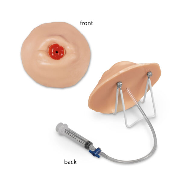 Modelo de treinamento para cuidados com ostomia retraída Life/form® [SKU: LF00903]