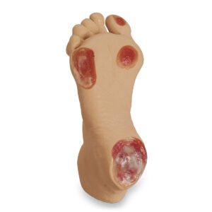 Pé para úlcera de pressão para idosos Life/form® – Leve [SKU: LF00933]