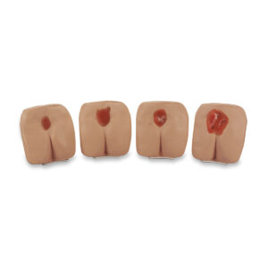 Modelos de úlcera/escaras de pressão Life/form® – Light [SKU: LF00934]