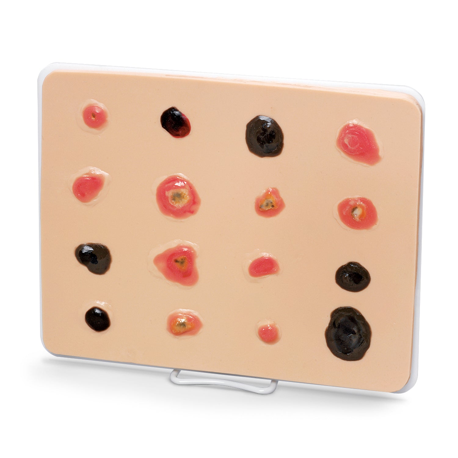 Life/form® Light Skin Cancer Trainer - Ampliado [SKU: LF00950]