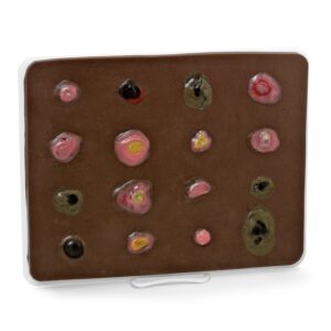 Life/form® Dark Skin Cancer Trainer – Ampliado [SKU: LF00951]