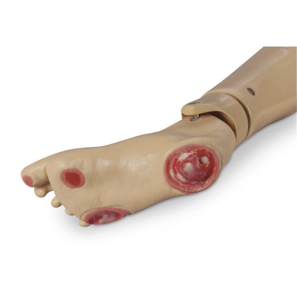 Pé para lesões por pressão opcional Life/form® GERi/ KERi – Leve [SKU: LF04041]
