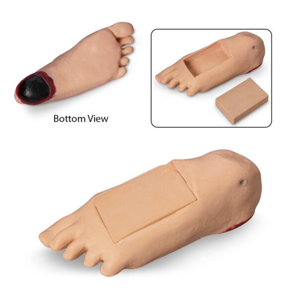 Life/form® GERi e KERi Opcional Edema Pé com Lesão Profunda do Tecido – Leve