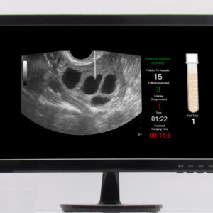 Monitor LCD SonoHysteroSim [SKU: SHSMON]