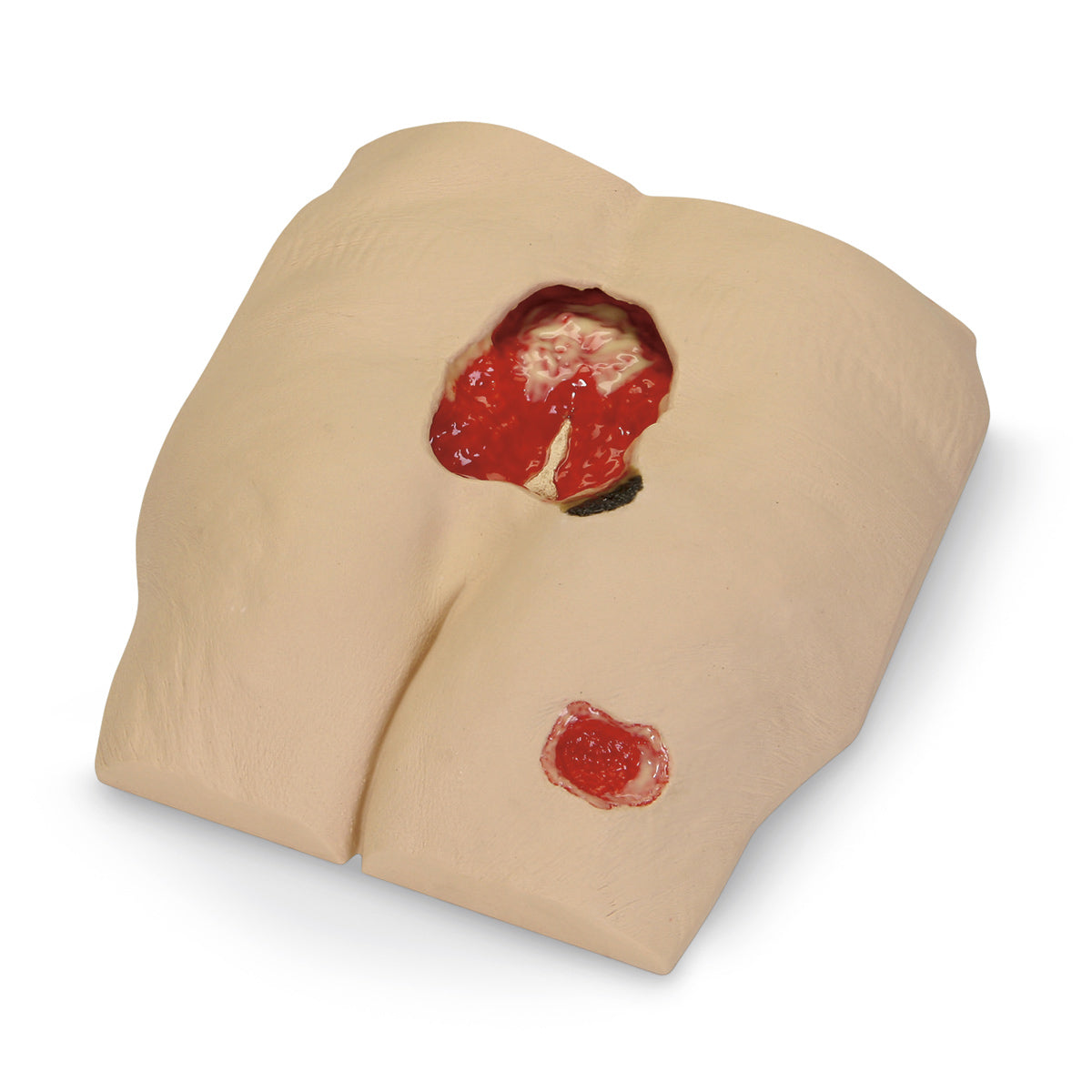 Modelo de lesão por pressão Stan Stage 4