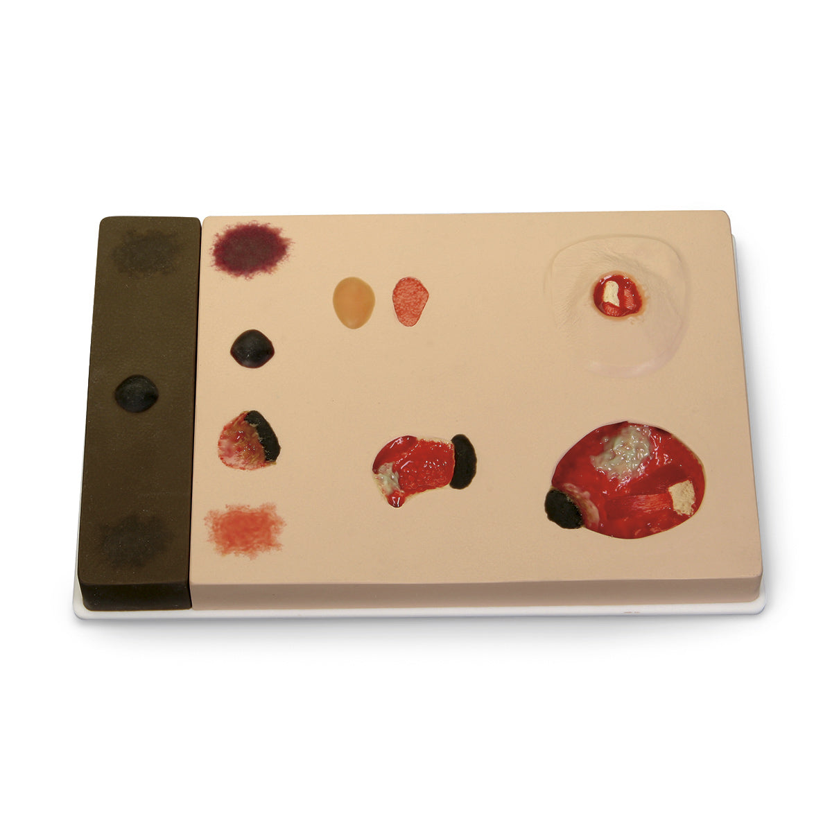 Modelo de estadiamento de lesão por pressão Pat